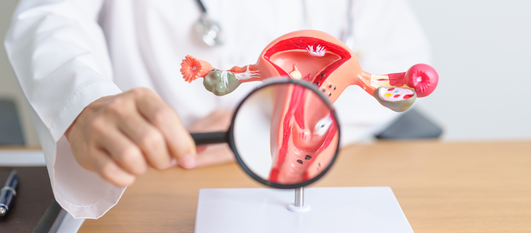 Doctor with Uterus and Ovaries anatomy model and magnifying glass. Ovarian and Cervical cancer, Cervix disorder, Endometriosis, Hysterectomy, Uterine fibroids, Reproductive system, Pregnancy